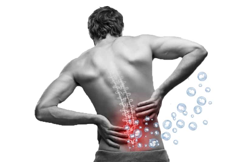 ozonoterapia per dolore ernia del disco