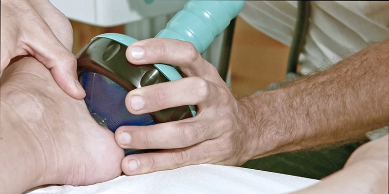 terapia con onde d'urto focali centro Magalini Medica