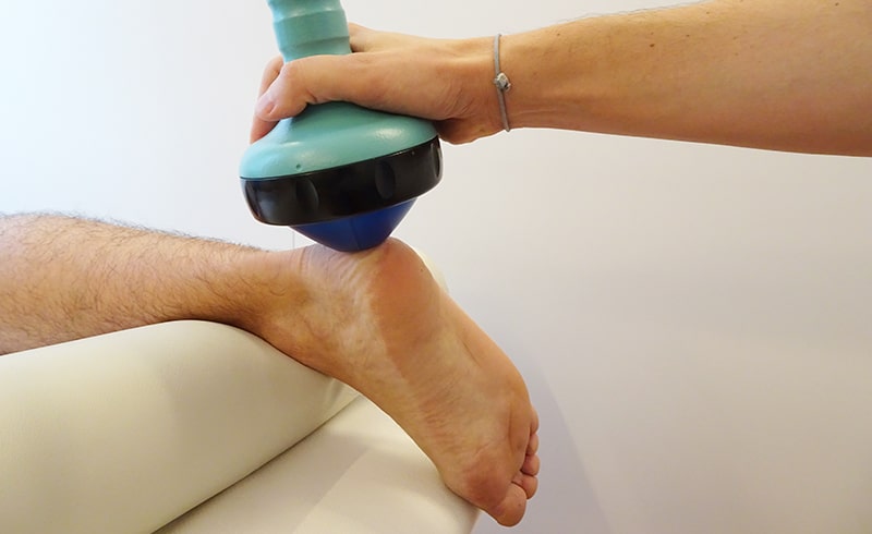 fisioterapista esegue terapia con onde d'urto al piede