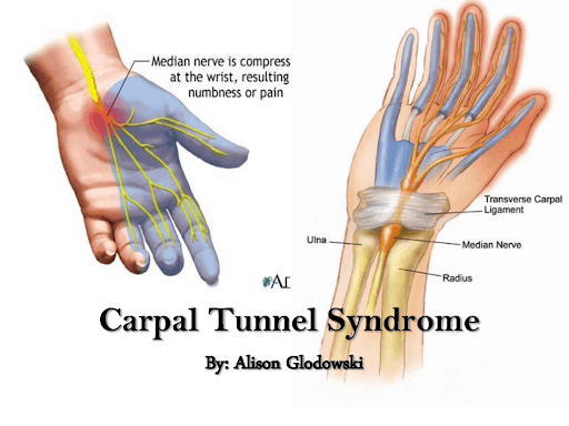 anatomia del tunnel carpale