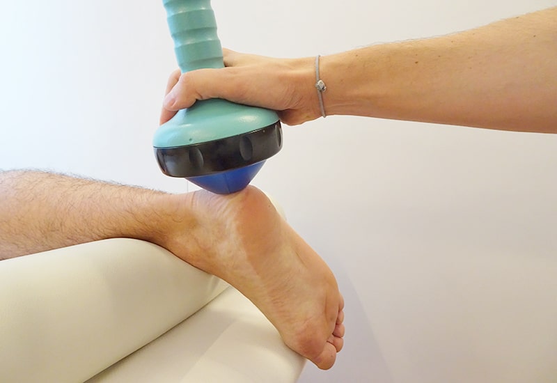 terapia onde d'urto al tallone per sperone calcaneare